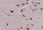 Phospho-PKC zeta (Thr410) Antibody in Immunohistochemistry (Paraffin) (IHC (P))