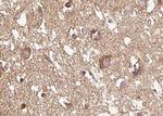 Phospho-NMDAR1 (Ser890) Antibody in Immunohistochemistry (Paraffin) (IHC (P))