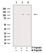 Phospho-NMDAR1 (Ser890) Antibody in Western Blot (WB)