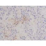 Phospho-Bcl-xL (Thr47) Antibody in Immunohistochemistry (Paraffin) (IHC (P))