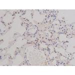 Phospho-Bcl-xL (Thr47) Antibody in Immunohistochemistry (Paraffin) (IHC (P))