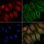 Phospho-FOXO1 (Ser329) Antibody in Immunocytochemistry (ICC/IF)