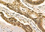 Phospho-FOXO1 (Ser256) Antibody in Immunohistochemistry (Paraffin) (IHC (P))