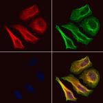 Phospho-FOXO1 (Ser319) Antibody in Immunocytochemistry (ICC/IF)