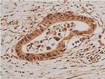 Phospho-FOXO1 (Ser319) Antibody in Immunohistochemistry (Paraffin) (IHC (P))