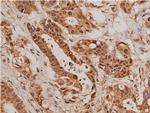 Phospho-FOXO1 (Ser319) Antibody in Immunohistochemistry (Paraffin) (IHC (P))