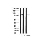 Phospho-FOXO1 (Ser319) Antibody in Western Blot (WB)