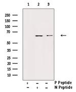 Phospho-IL10RA (Tyr496) Antibody in Western Blot (WB)