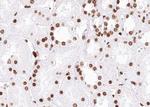 Phospho-SMC1 (Ser957) Antibody in Immunohistochemistry (Paraffin) (IHC (P))