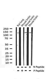 Phospho-SMC1 (Ser957) Antibody in Western Blot (WB)