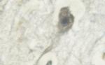 Phospho-PKC mu (Tyr463) Antibody in Immunohistochemistry (IHC)