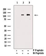 Phospho-PKC mu (Tyr463) Antibody in Western Blot (WB)