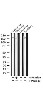 Phospho-ErbB4 (Tyr1284) Antibody in Western Blot (WB)