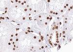 Phospho-SMAD2 (Ser467) Antibody in Immunohistochemistry (Paraffin) (IHC (P))