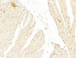 Phospho-SMAD2 (Ser467) Antibody in Immunohistochemistry (Paraffin) (IHC (P))