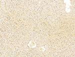 Phospho-SMAD2 (Ser467) Antibody in Immunohistochemistry (Paraffin) (IHC (P))