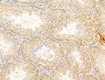 Phospho-SMAD2 (Ser467) Antibody in Immunohistochemistry (Paraffin) (IHC (P))