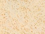 Phospho-SMAD2 (Ser467) Antibody in Immunohistochemistry (Paraffin) (IHC (P))