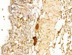 Phospho-SMAD2 (Ser467) Antibody in Immunohistochemistry (Paraffin) (IHC (P))