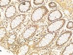 Phospho-SMAD2 (Ser467) Antibody in Immunohistochemistry (Paraffin) (IHC (P))