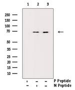 Phospho-SMAD2 (Ser250) Antibody in Western Blot (WB)