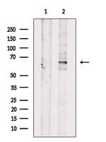 Phospho-SMAD1 (Ser465) Antibody in Western Blot (WB)