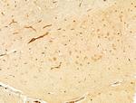 Phospho-p38 MAPK alpha (Tyr182) Antibody in Immunohistochemistry (Paraffin) (IHC (P))