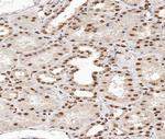 Phospho-p38 MAPK alpha (Tyr182) Antibody in Immunohistochemistry (Paraffin) (IHC (P))