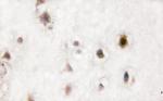 Phospho-p38 MAPK alpha (Tyr323) Antibody in Immunohistochemistry (Paraffin) (IHC (P))