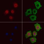 Phospho-p38 MAPK alpha (Thr180) Antibody in Immunocytochemistry (ICC/IF)