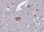 Phospho-TRKB (Tyr706) Antibody in Immunohistochemistry (Paraffin) (IHC (P))