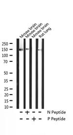 Phospho-TRKB (Tyr706) Antibody in Western Blot (WB)