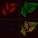 Phospho-BAD (Ser118) Antibody in Immunocytochemistry (ICC/IF)