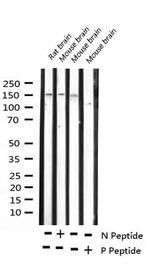 Phospho-ASK1 (Ser966) Antibody in Western Blot (WB)