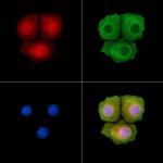 Phospho-FANCD2 (Ser222) Antibody in Immunocytochemistry (ICC/IF)