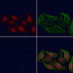 Phospho-HDAC6 (Ser22) Antibody in Immunocytochemistry (ICC/IF)