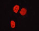 Phospho-HDAC6 (Ser22) Antibody in Immunocytochemistry (ICC/IF)