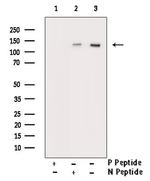 Phospho-HDAC6 (Ser22) Antibody in Western Blot (WB)