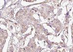 Phospho-DARPP-32 (Thr75) Antibody in Immunohistochemistry (Paraffin) (IHC (P))