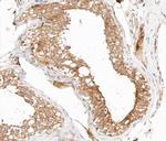 Phospho-IKK gamma (Ser31) Antibody in Immunohistochemistry (Paraffin) (IHC (P))