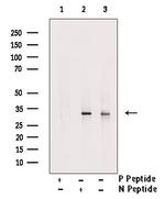 Phospho-SLUG (Ser104) Antibody in Western Blot (WB)