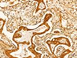 CASPASE 1 P10 (CLEAVED ALA317) Antibody in Immunohistochemistry (Paraffin) (IHC (P))