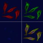 Phospho-ROCK1 (Tyr913) Antibody in Immunocytochemistry (ICC/IF)