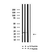 Phospho-Claudin 5 (Thr207 ) Antibody in Western Blot (WB)