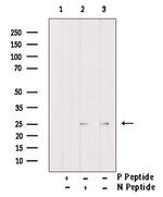 Phospho-Claudin 5 (Thr207 ) Antibody in Western Blot (WB)