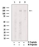 Phospho-SIN3A (Ser832) Antibody in Western Blot (WB)