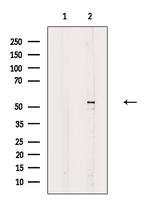 Phospho-MST2 (Ser316) Antibody in Western Blot (WB)