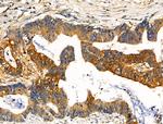 Phospho-NEDD4 (Ser670) Antibody in Immunohistochemistry (Paraffin) (IHC (P))