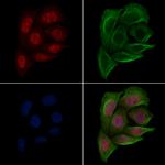 Phospho-PABPN1 (Ser150) Antibody in Immunocytochemistry (ICC/IF)