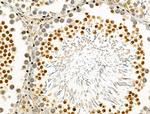 Phospho-PABPN1 (Ser150) Antibody in Immunohistochemistry (Paraffin) (IHC (P))